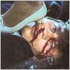 Accident : photo
