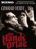 Photo : Les Mains D'Orlac