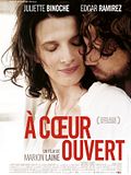 Photo : À cœur ouvert